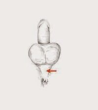 músculos potenciales y su tensión para aumentar el potencial